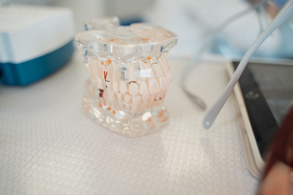 A clear teaching model of the jaw showing an implant post set into the bone